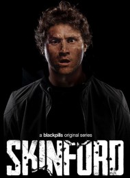 Skinford - Saison 1